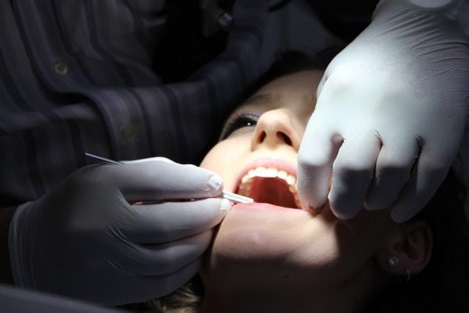 teeth cleaning