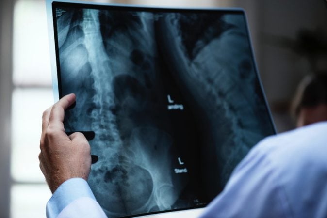 x-ray in bangkok