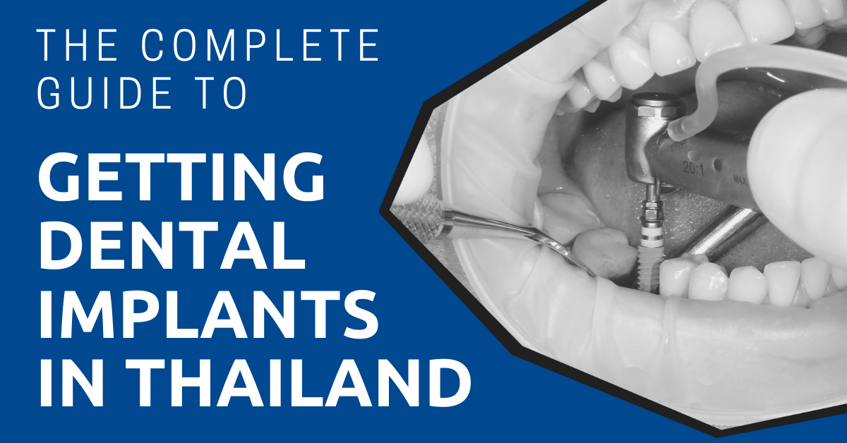 Dental Implants in Thailand