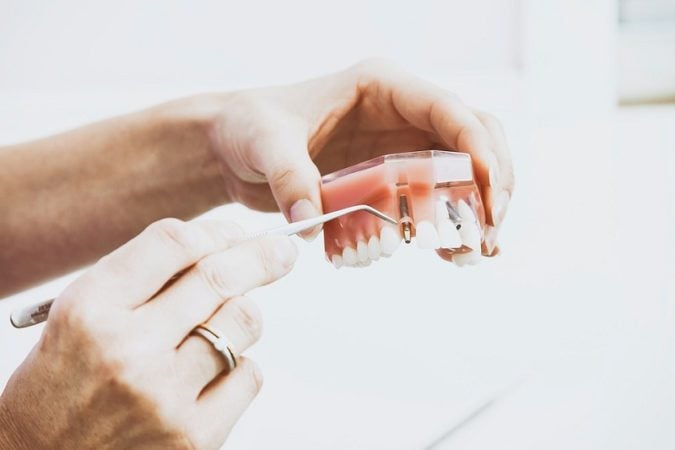 dental implant model. 