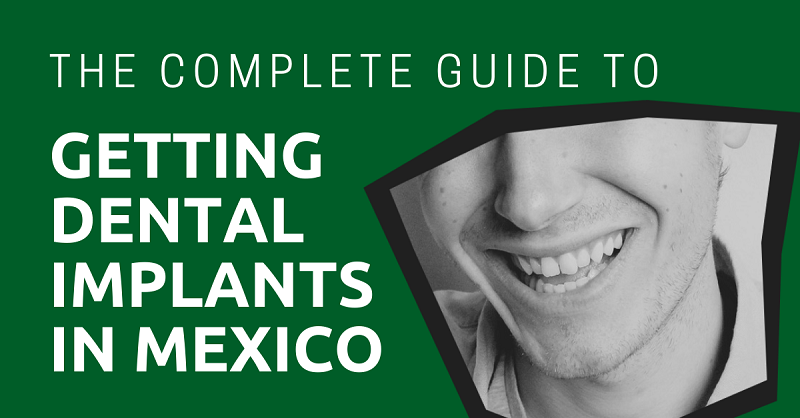 The Complete Guide to Getting Dental Implants in Mexico