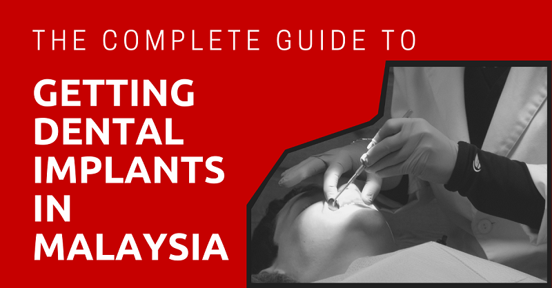 The Complete Guide to Getting Dental Implants in Malaysia