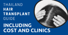 Thailand Hair Transplant Guide, including Cost and Clinics