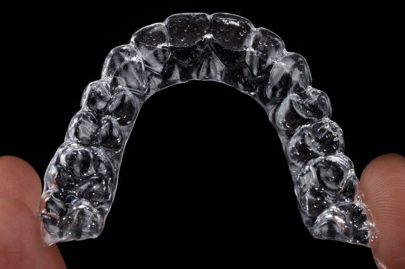 Invisalign braces