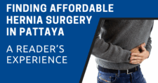 Finding Affordable Hernia Surgery in Pattaya: A Reader’s Experience